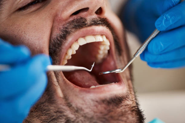 Best Emergency Dental Care for Abscessed Tooth in Jefferson, GA