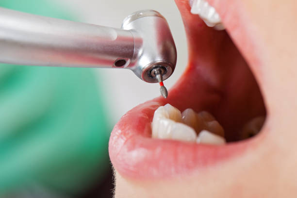 Best Broken or Cracked Tooth Emergency Dentist in Jefferson, GA